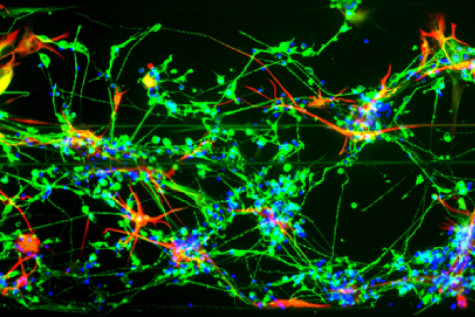 IPSC衍生神经元和星形胶质细胞的共同培养
