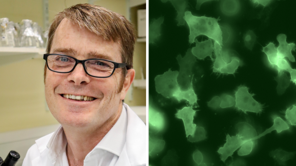 罗宾·威廉姆斯教授和盘基网柄菌的显微镜图像