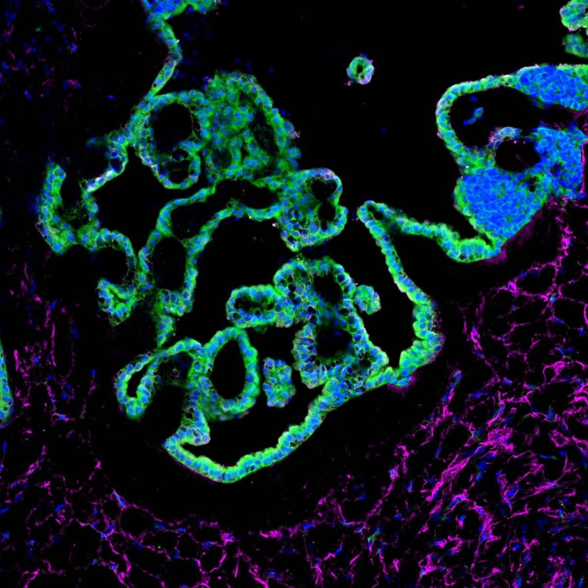 脉络膜丛类器官切片，上皮细胞(绿色)和基质细胞(品红)染色。