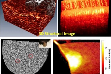 具有功能性光学相干断层扫描的组织成像组织的四个3D结构图像