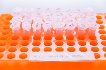一个橙色的Eppendorf架子，上面部分放着PCR管。
